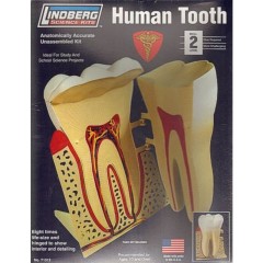 Kit para montar diente